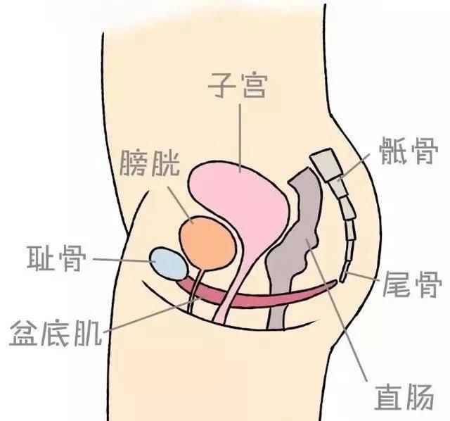 盆底肌修复